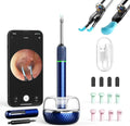 Ear Wax Removal Tool Camera, 10 Megapixels Otoscope, 12 Ear Spoon, Blue W9868